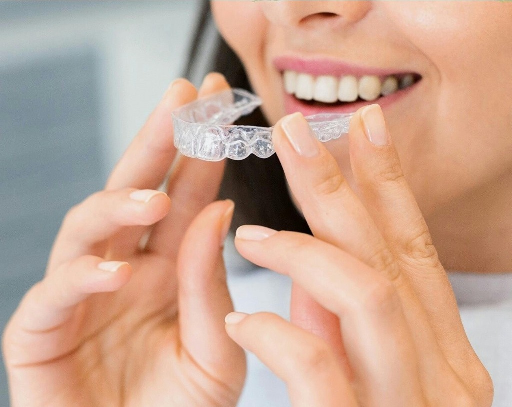 Clear Aligners - Bilal Dental Lounge