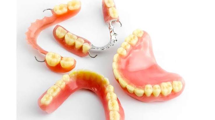 Dentures - Bilal Dental Lounge