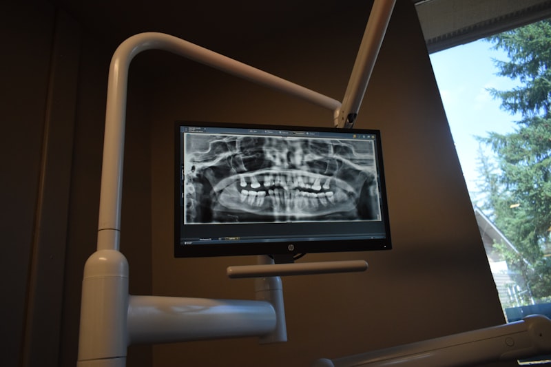 Digital Dental X-Ray - Bilal Dental Lounge